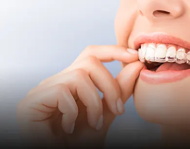 Invisalign in London by Piccadilly Dental Clinic